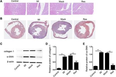 Resveratrol Attenuate Myocardial Injury by Inhibiting Ferroptosis Via Inducing KAT5/GPX4 in Myocardial Infarction